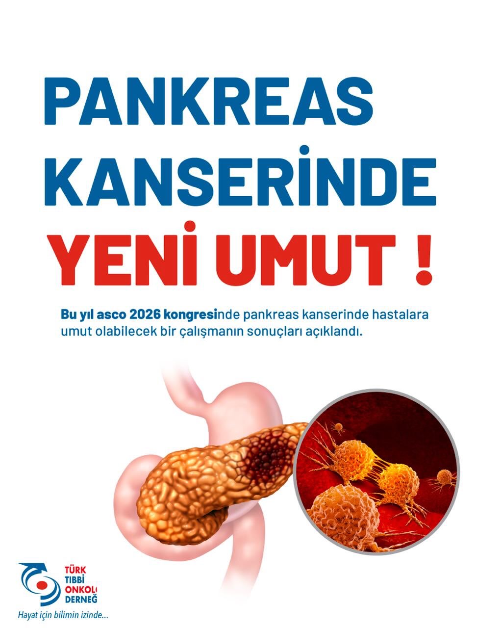 #PankreasKanseri